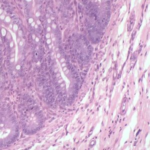 Lâminas Preparadas de Histologia 80pçs/cx